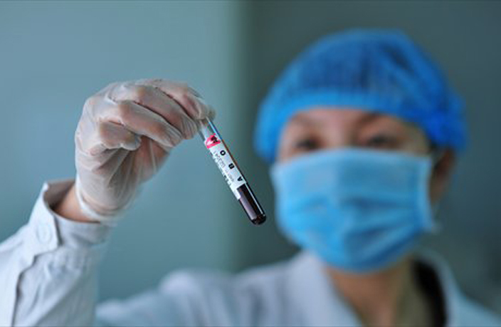 Alarming Rise in AIDS-Infected Foreigners in China
