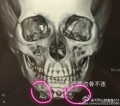 Shanghai plastic surgery