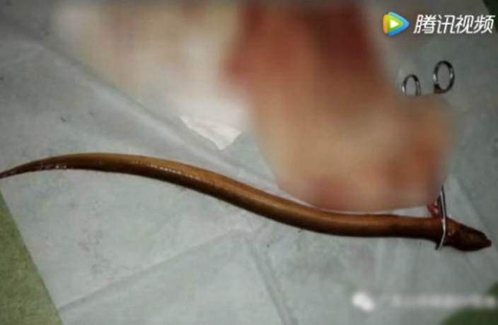 Eels Ass Video