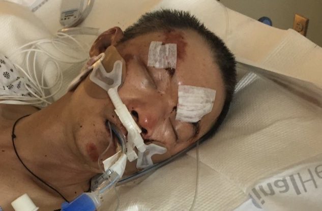 Guangdong Man Latest Victim of Asian Hate Crime in US