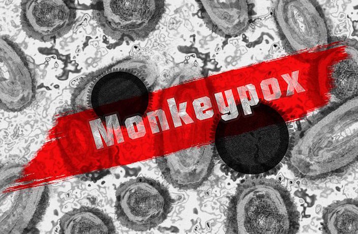 1 New COVID Case in Shanghai, Monkeypox in Chongqing