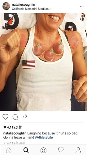 Natalie Coughlin Cupping