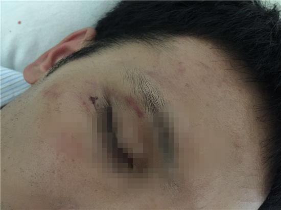 vietnam mong cai border injuries eye