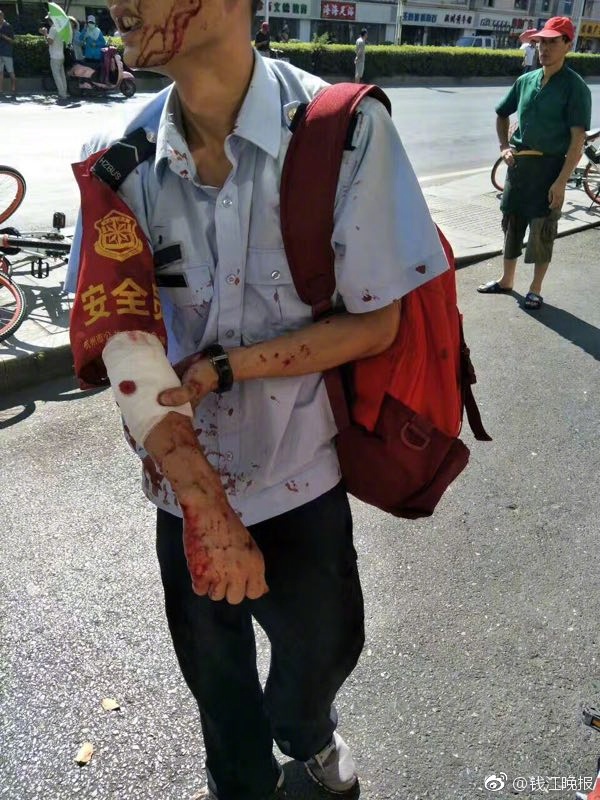 hangzhou-explosion-injured.jpeg