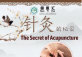 The Secret of Acupuncture