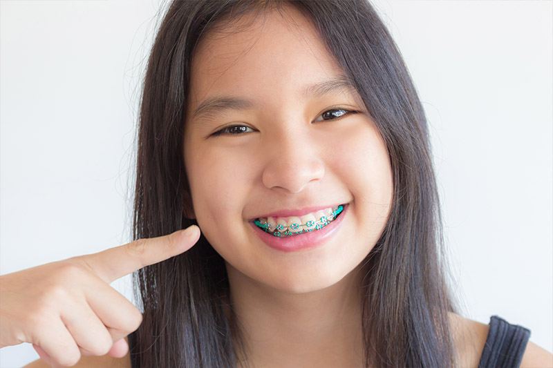 Why Summer is the Perfect Time for Orthodontics Treatment