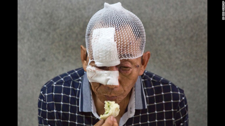 An old man injured in the Tianjin explosions