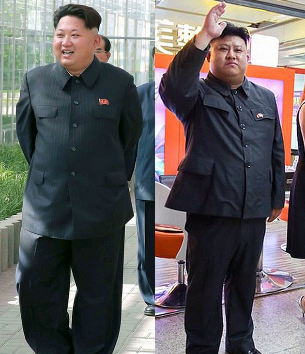 Chinese fan has plastic surgery to look like Kim Jong-un